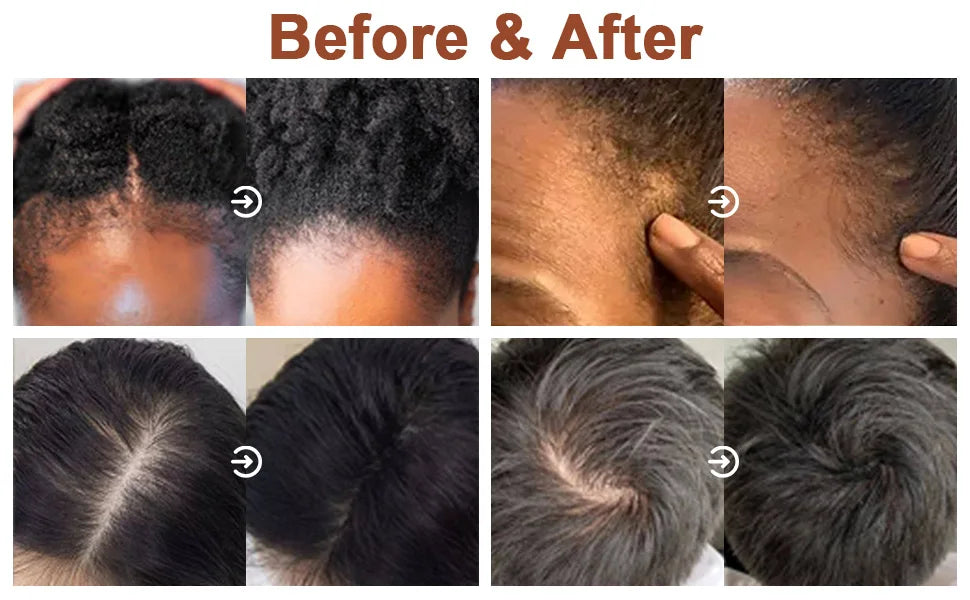 LOCKMIO 120g huile de Batana pour nourrir en profondeur racines revitalisant de Batana naturel améliorer les frisottis cheveux femmes produits de soins capillaires pour les femmes
