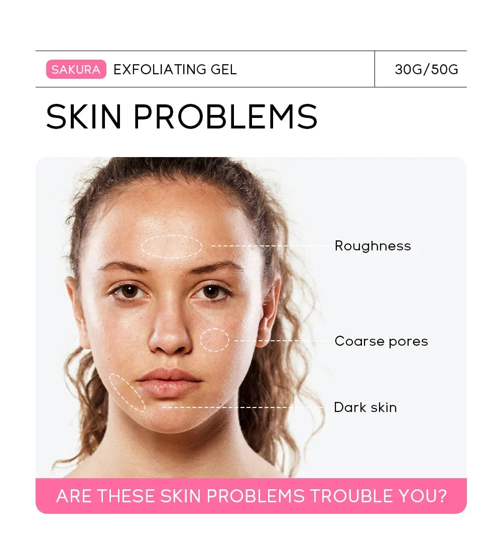 Gel exfoliant Sakura, gommage facial, hydratant, nourrissant, réparateur, crème pour le visage, soin de la peau, 30g/50g