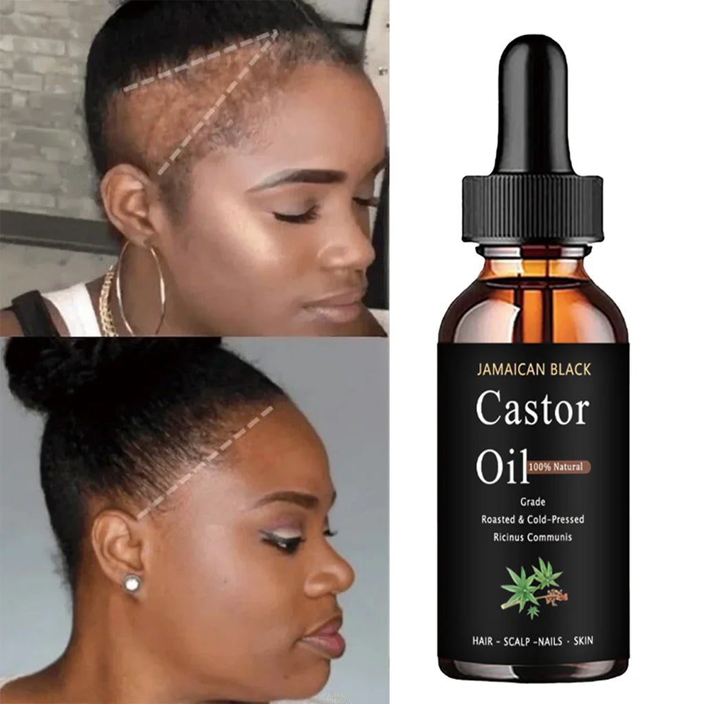 TRSTAY Jamaïque noir pur naturel huile de ricin traitement des cheveux hydratant fort cuir chevelu environnement soins capillaires sains